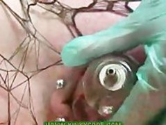 Needle Thumb