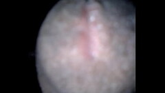 Tension matinal Thumb