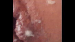 Massage de ano Thumb